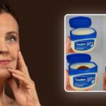 El Remedio Natural para Eliminar Arrugas y Rejuvenecer la Piel – Remedios Naturales para la Salud y Bienestar